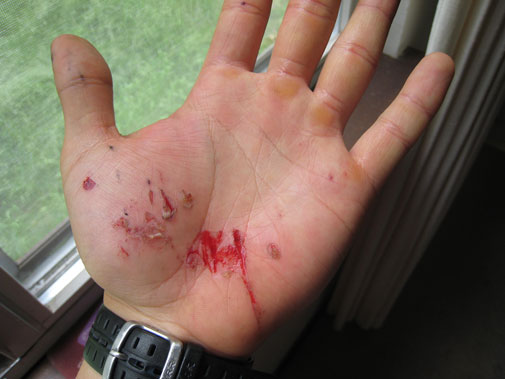 left_hand_wound.jpg